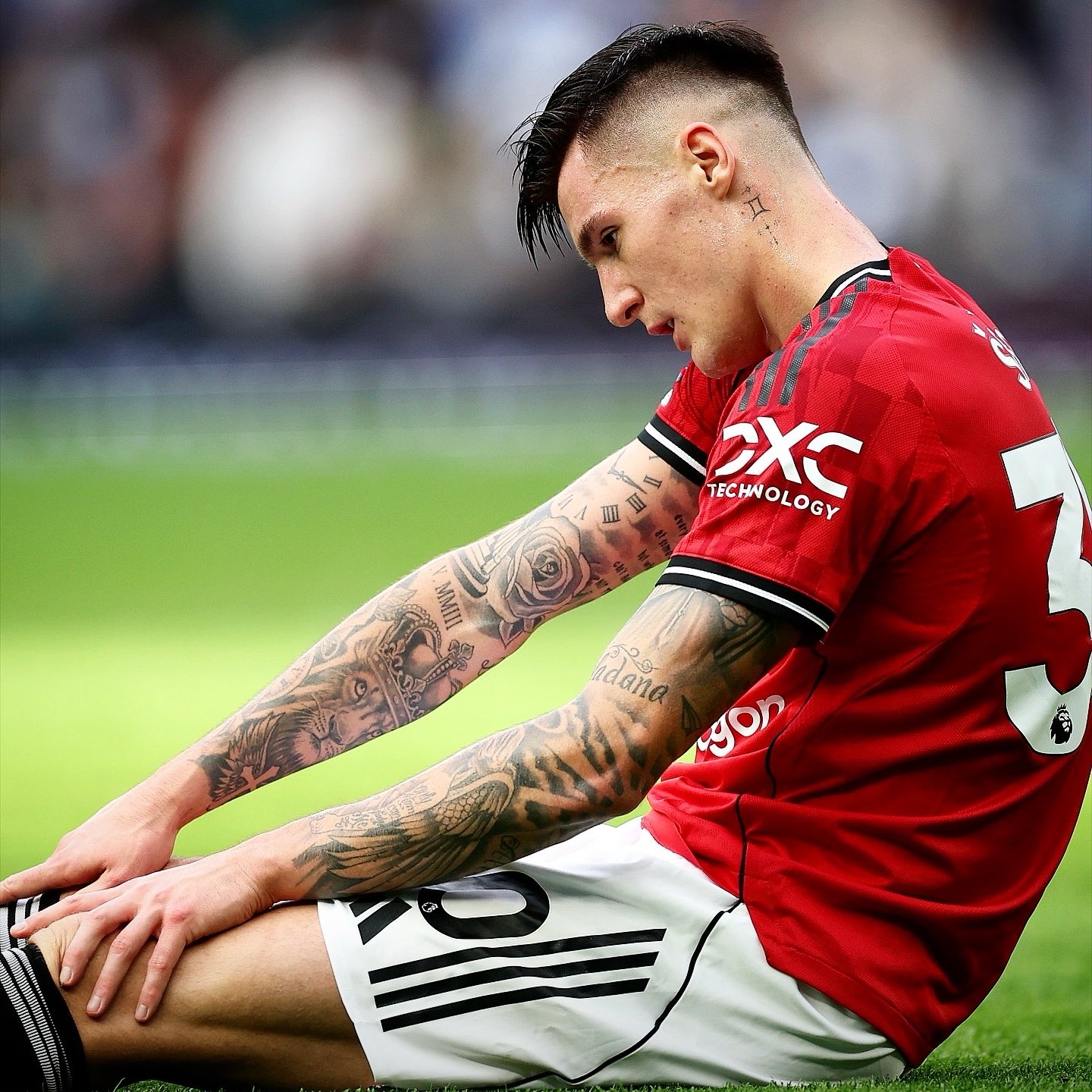 ข่าวแมนยู - อโมริม รับ ! กังวลเรื่องโรคเดี้ยงของ เซสโก้